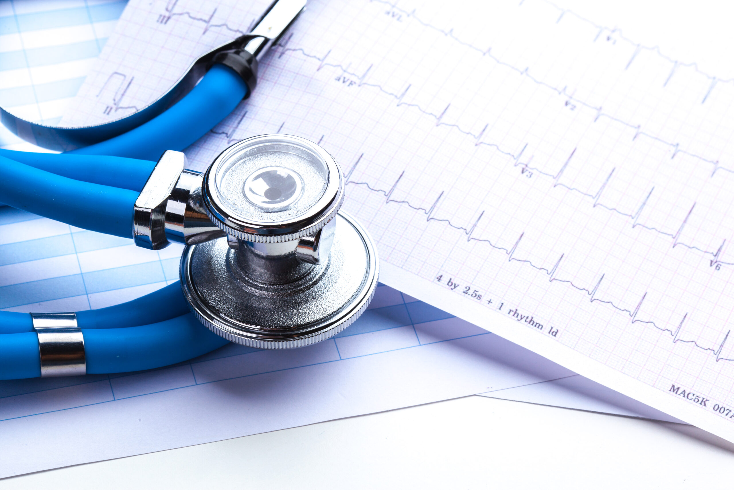 Stethoscope on cardiogram sheet